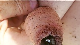WARNING: Maggots Eating My Dick - Here's What You Need to Know Now
